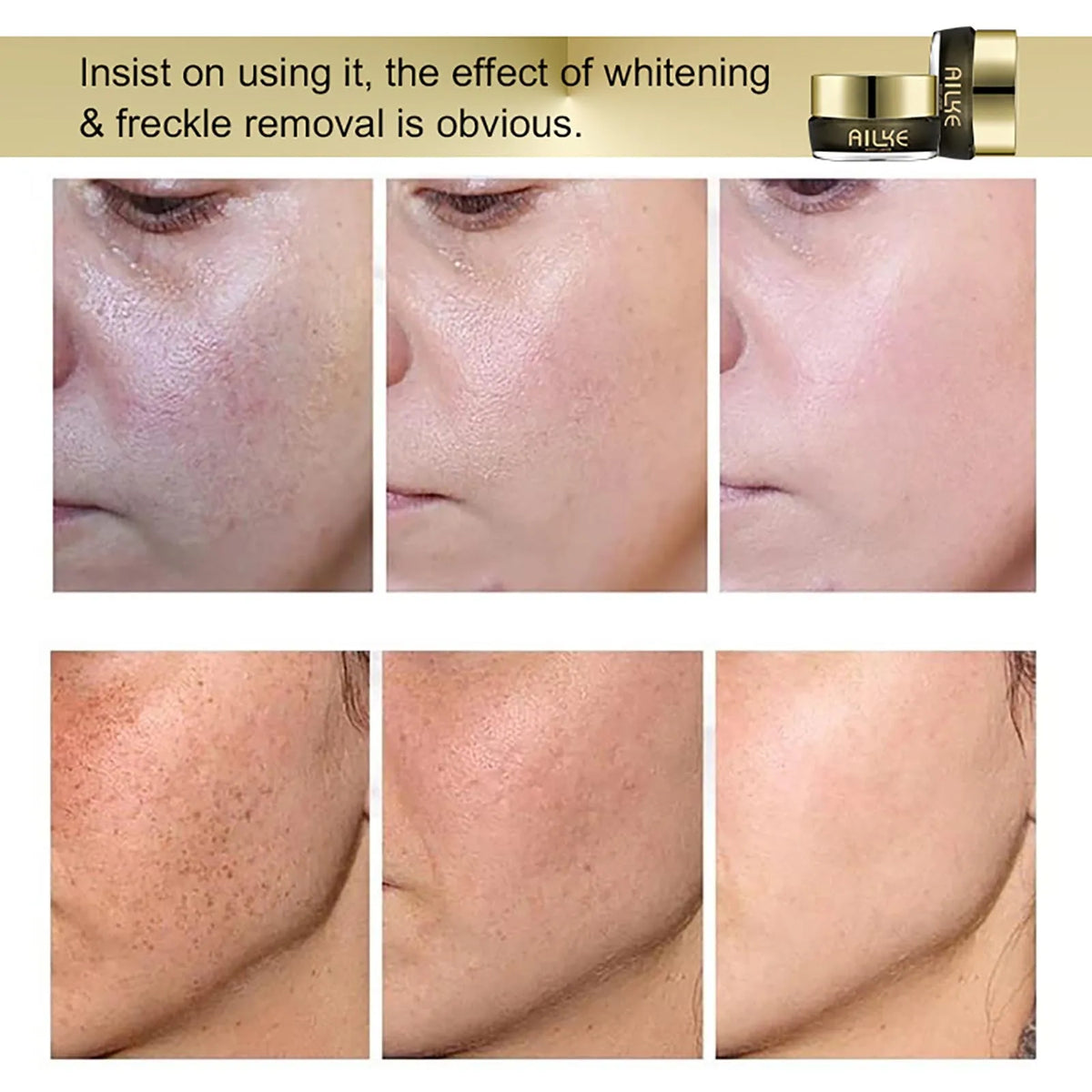 AILKE Whitening Face Cream for Dark Spots and Even Tone