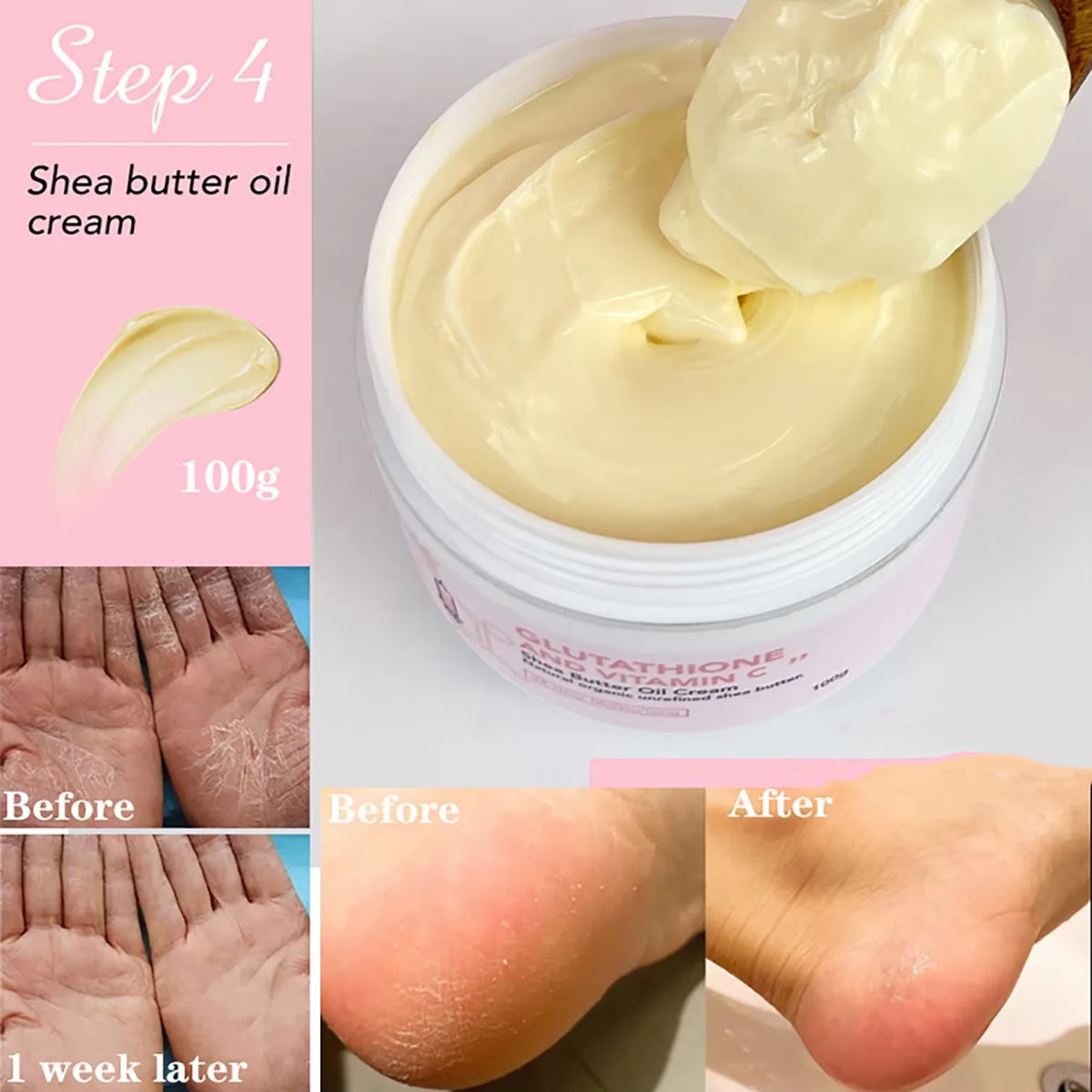 Ailke Shea Butter Whitening Cream for Face and Body Moisturizing